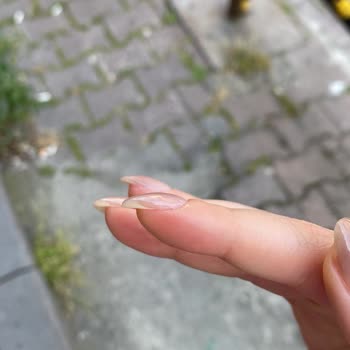 Nişan Öncesi Kötü Tırnak Deneyimi Ve Saygısız Yaklaşım