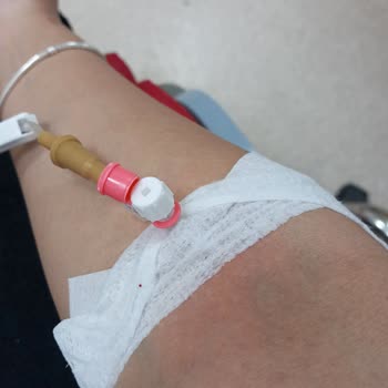 Tavuk Burger Sonrası Yaşadığım Gıda Zehirlenmesi Ve Hastane Süreci