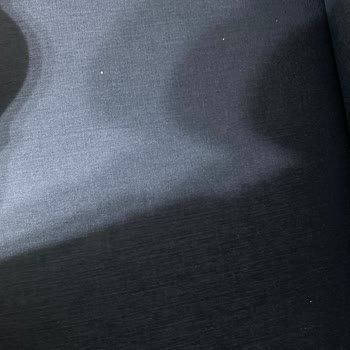 Koltuk Kumaşı Hayal Kırıklığı Ve Çözüm Yok