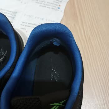 Reebok Ayakkabının Kısa Sürede Deformesi Ve Kullanıcı Hatası Denilmesi