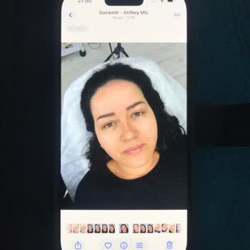 İphone 16'nın Kamera Kalitesi Hayal Kırıklığı Yarattı, Destek Yetersiz Kaldı