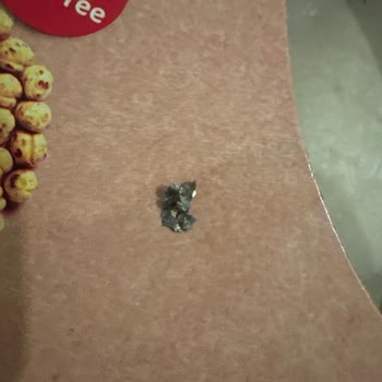 Kurabiyeden Çıkan Metal Parçası Diş Etimi Yaraladı