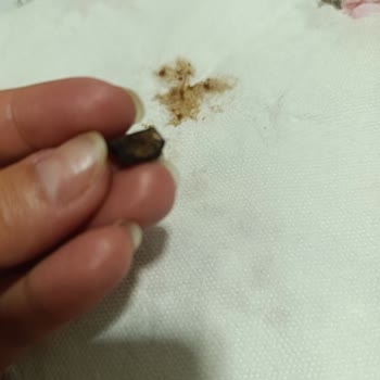 Coco Pops Gevreklerinde Sert Cisim Tehlikesi: Çocuklarımın Sağlığı Riske Girdi