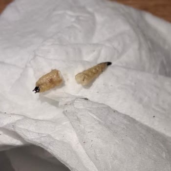 Ay Çekirdeğinden Çıkan Kurt İle Yaşadığım Hijyen Sorunu