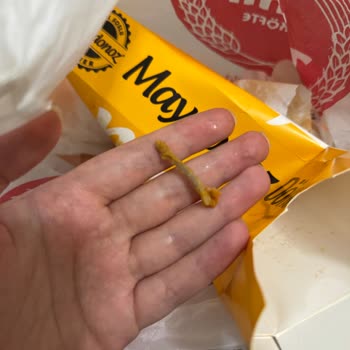 Dürümde Kemik Parçası Çıkması Nedeniyle Yaşanan Tehlikeli Durum