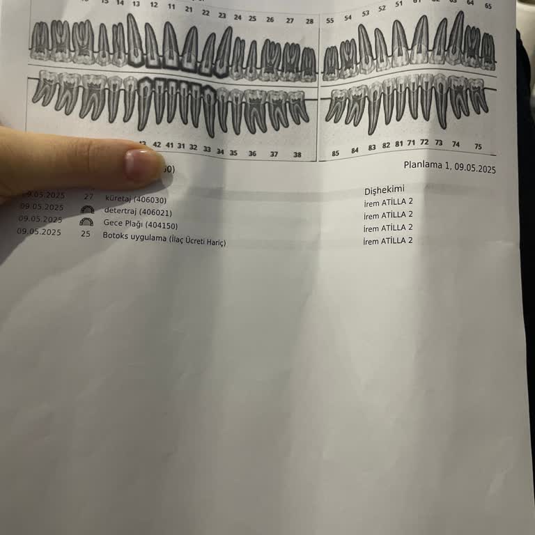 Zirkonyum Sonrası Yaşadığım Ağrılar Ve İletişim Sorunları