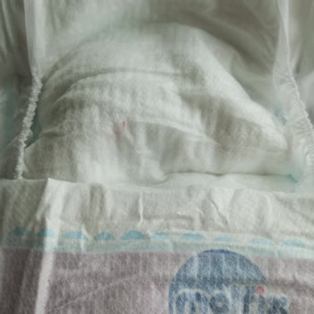 Bebek Bezinde Sert Plastik Tel Şoku