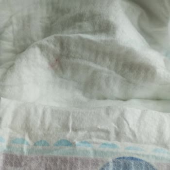 Bebek Bezinde Sert Plastik Tel Şoku