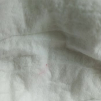 Bebek Bezinde Sert Plastik Tel Şoku