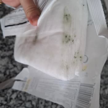 Bebek Islak Mendilinde Küf Ve Kötü Koku Şoku