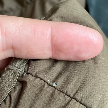 Bir Yıllık Montta Dikiş Sorunu Ve Yetersiz Çözüm