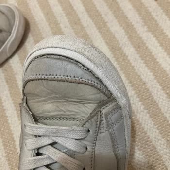 Satın Aldığım Ayakkabıda Açılma Ve Müşteri Hizmetlerine Ulaşamama Sorunu