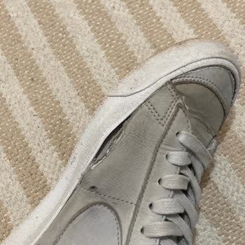 Satın Aldığım Ayakkabıda Açılma Ve Müşteri Hizmetlerine Ulaşamama Sorunu