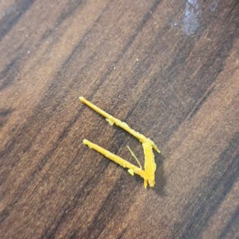 Aldığım Cipsin İçinden Tahta Parçası Çıktı, Çocuğum Tehlike Atlattı