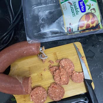 Torku Sucukta Kıl Ve Farklılıklar Sağlığımı Riske Attı