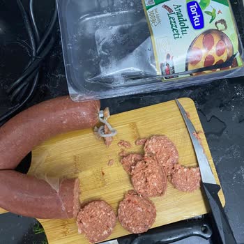 Torku Sucukta Kıl Ve Farklılıklar Sağlığımı Riske Attı