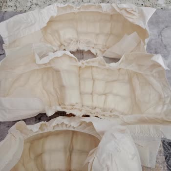 Defolu Bebek Bezleri Nedeniyle Kızım Hasta Oldu, Mağduriyetim Giderilsin