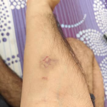 Liv Hospital'da Hemşire Deneyimsizliği Ve Sürekli Yaşanan Sorunlar
