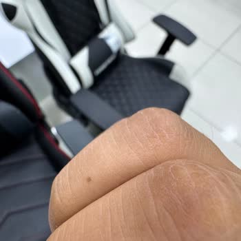 Marlboro Edge Sigara İçindeki Yabancı Maddeler Yanıklara Sebep Oldu