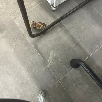 Saçlarımın Yıpranması Sonrası Yaşadığım Mağduriyet