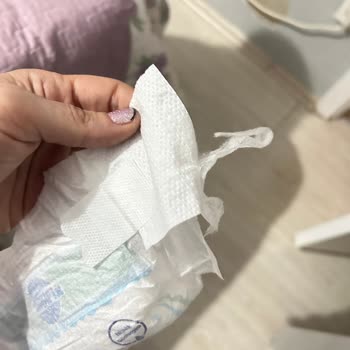 Aldığım Molfix Bebek Bezi Yırtık Ve Defolu Çıktı, Muhatap Bulamıyorum