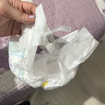 Aldığım Molfix Bebek Bezi Yırtık Ve Defolu Çıktı, Muhatap Bulamıyorum