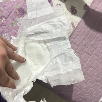 Aldığım Molfix Bebek Bezi Yırtık Ve Defolu Çıktı, Muhatap Bulamıyorum