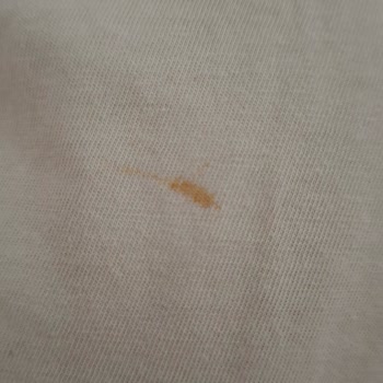 Altus Çamaşır Makinesi Pas Lekesi Sorunu Ve Çözüm Eksikliği