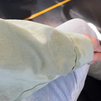 Uçuşta Paslı Su Nedeniyle Kıyafetlerim Zarar Gördü, Mağduriyet Yaşadım