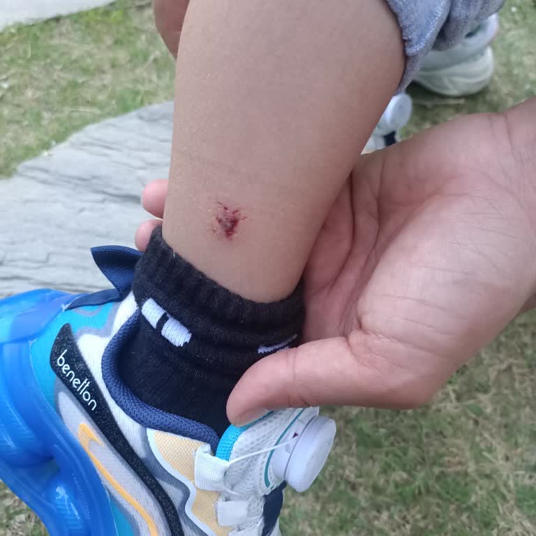 Oğlumuzu Köpek Isırdı İşletme Sorumluluk Almadı