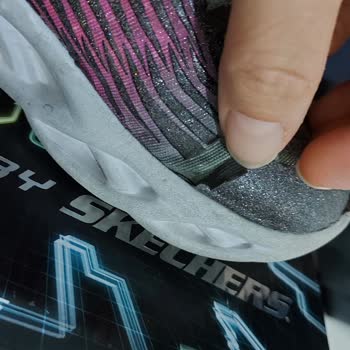 Skechers Çocuk Ayakkabısında Kısa Sürede Kaplama Soyulması Ve Yetersiz İnceleme