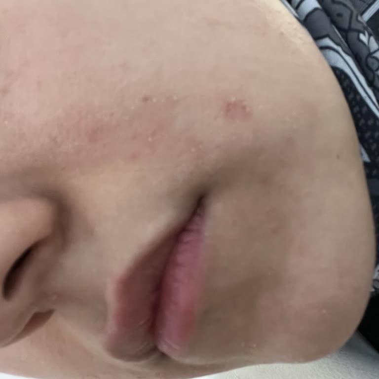 Pure Beauty BB Krem Yüzümde Kuruluk Ve Soyulma Yaptı, İade Talebim Reddedildi