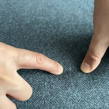 Enza Home'dan Aldığım Koltukta Kumaş Açılması Ve Müşteri Hizmetlerinde Hayal Kırıklığı