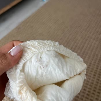 Sleepy Ecologic Bebek Bezlerinde Yırtık Ve Parça Dökülmesi Şoku