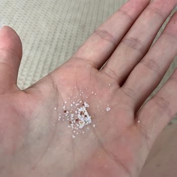 Sleepy Ecologic Bebek Bezlerinde Yırtık Ve Parça Dökülmesi Şoku