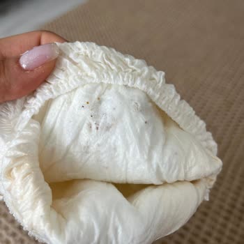 Sleepy Ecologic Bebek Bezlerinde Yırtık Ve Parça Dökülmesi Şoku