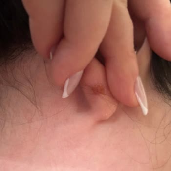 Swarovski Küpe Seti Alerji Yaptı, Müşteri Hizmetlerinden Yetersiz Destek