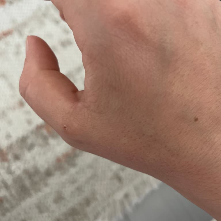 Dyson Süpürgede Tetik Kısmı Sağlık Problemi Oluşturdu