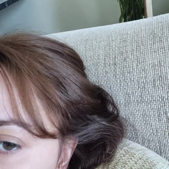 Beklediğim Renk Yerine Kızıl Ve Kaşıntı Sorunu Yaşadım