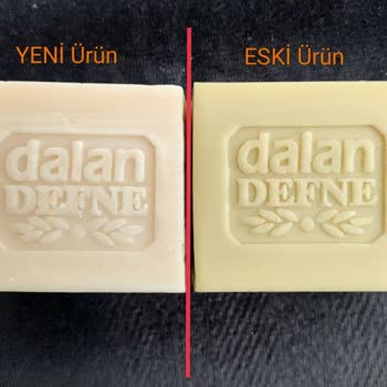 Ürün İçeriği Ve Kalitesindeki Değişiklik Çocuğumda Alerjiye Sebep Oldu