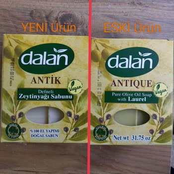 Ürün İçeriği Ve Kalitesindeki Değişiklik Çocuğumda Alerjiye Sebep Oldu