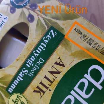 Ürün İçeriği Ve Kalitesindeki Değişiklik Çocuğumda Alerjiye Sebep Oldu