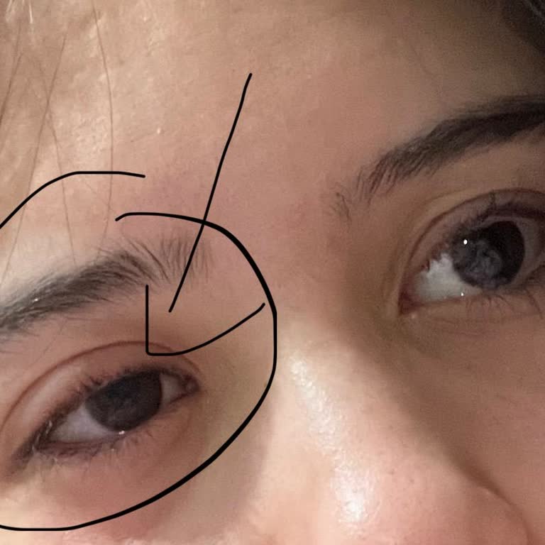 Maybelline Maskara Sonrası Gözümde Ciddi Batma Ve Şişlik Sorunu Yaşadım