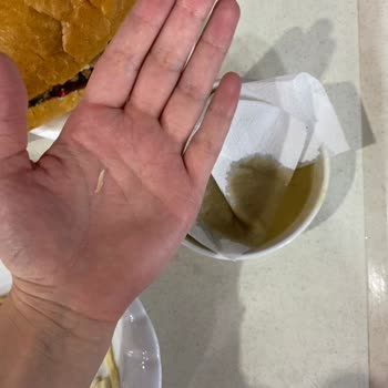 Mersin Kız Yurdu Yemeklerinde Hijyen Ve Fahiş Fiyat Sorunu