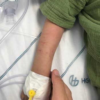 Acilde Yanlış Damar Yolu Uygulamasıyla Çocuğumun Kolu Zarar Gördü