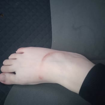 Decathlon Çocuk Paleti Ayağa Zarar Verdi, İade Kabul Edilmedi