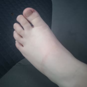 Decathlon Çocuk Paleti Ayağa Zarar Verdi, İade Kabul Edilmedi