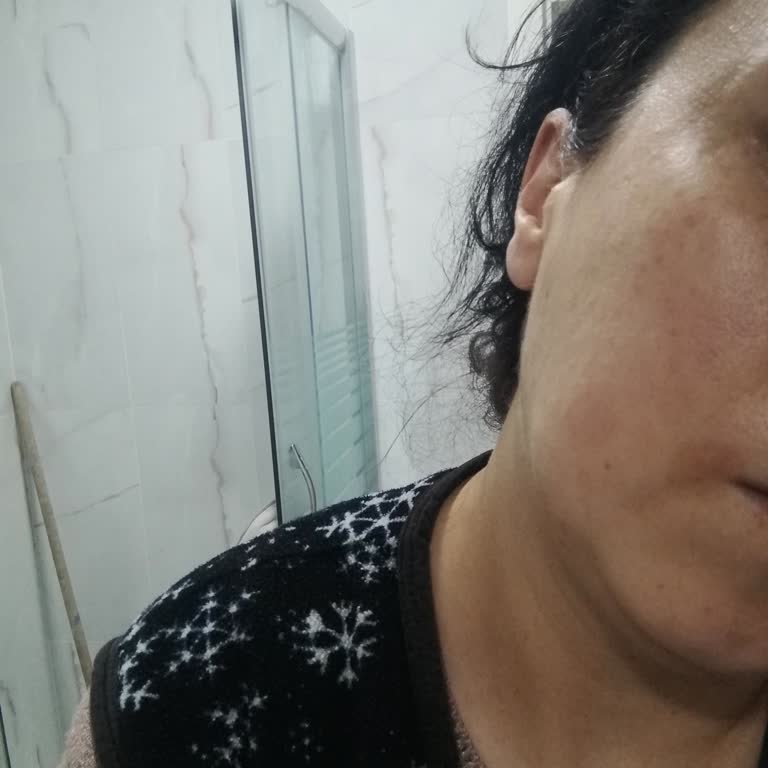 BKM Güzellik Salonu Gençlik Aşısı Leke Yapması