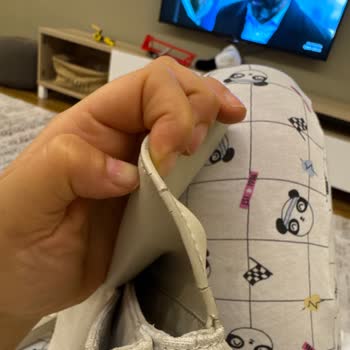 Yüksek Fiyatlı Çantada Deri Dökülmesi Ve Metalde Pembeleşme Sorunu