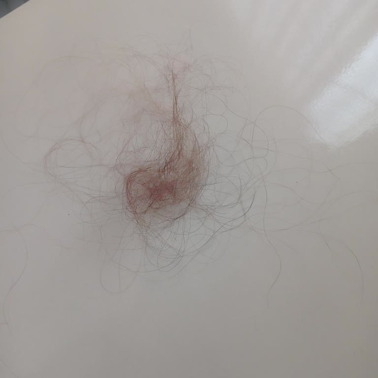 Ekstra Ücret Ve Kalitesiz Hizmet Sonrası Mağduriyet